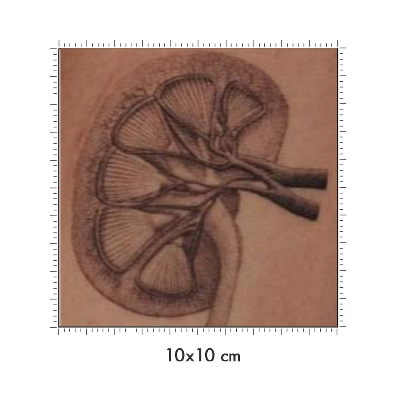 10 x 10 cm