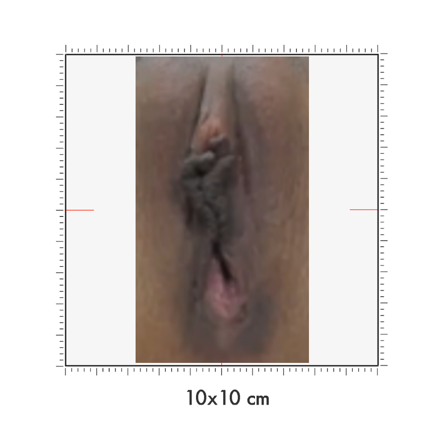 10 x 10 cm