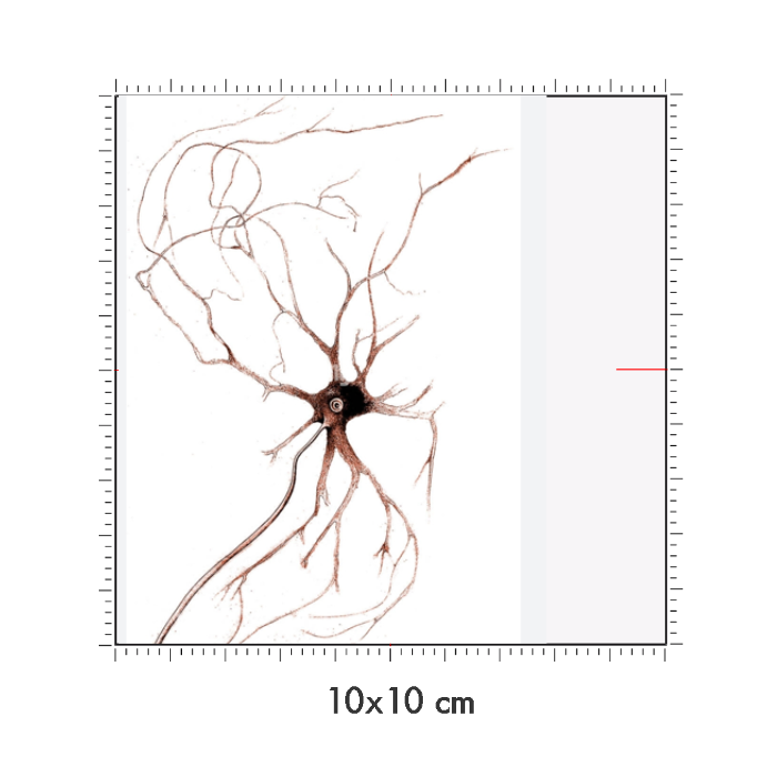 10 x 10 cm